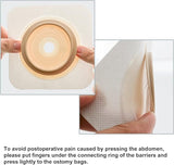TERUMED 2360 Two-Piece Colostomy Bag (60MM) with 3360 Flat Baseplate for Colostomy | Ileostomy (60MM)